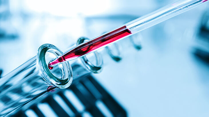 MPV Nedir? MPV Yüksekliği ve Düşüklüğü Belirtileri