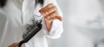 Saç dökülmesi tedavisi nasıl yapılır?
