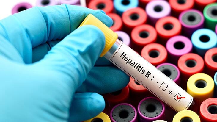 Hepatit B testi